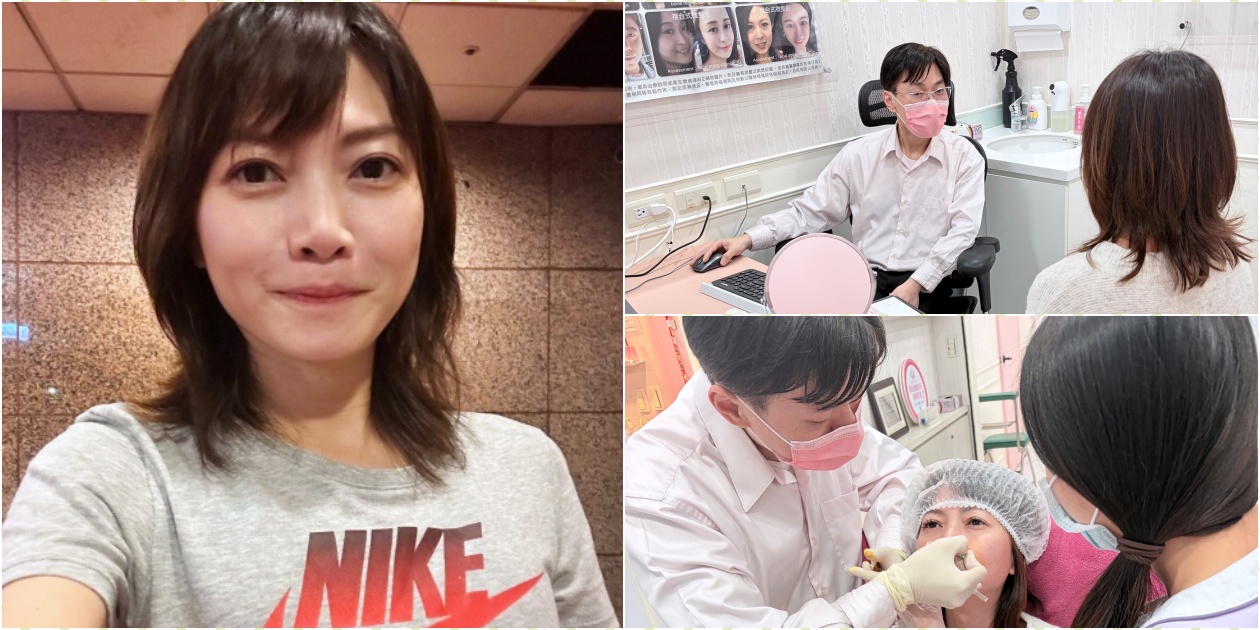 告別老態紋！4D無痕筋膜提升法令紋心得真實體驗(含材質及恢復期) - 老皮嫩肉的流水帳生活